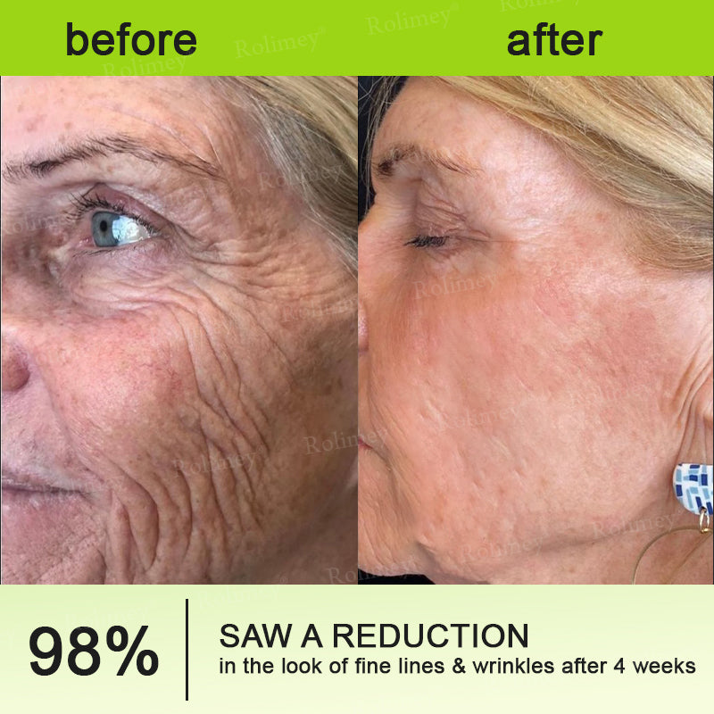 👨‍⚕️Made and shipped from Australia💫 Vita-A Retinol Shot Wrinkle-Lift Tightening cream - Last Day Promotion 70% OFF