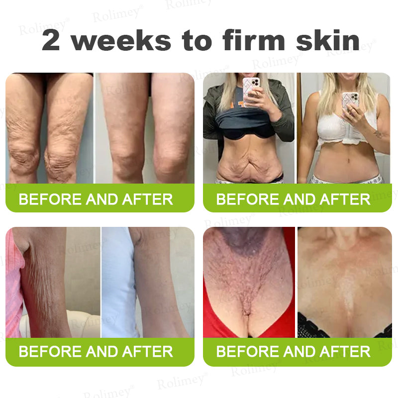 👨‍⚕️Made and shipped from Australia💫 Vita-A Retinol Shot Wrinkle-Lift Tightening cream - Last Day Promotion 70% OFF