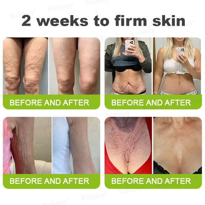 👨‍⚕️Made and shipped from Australia💫 Vita-A Retinol Shot Wrinkle-Lift Tightening cream - Last Day Promotion 70% OFF